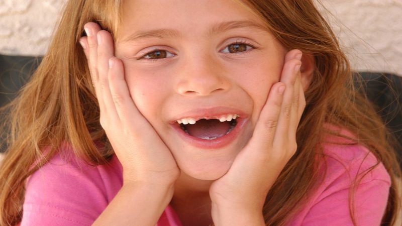 Mơ thấy rụng răng ẩn chứa ý nghĩa đặc biệt gì?